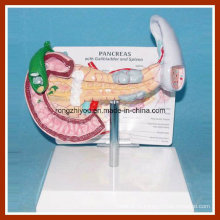 Human Health Spleen, Pancreas, Gallstone Model for Medical Teaching